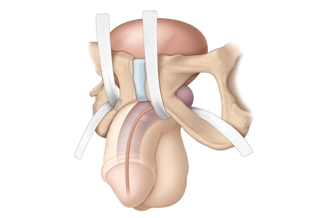 places that are examined for the presence of filler